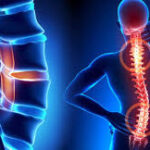 Comprehensive Guide to Spine Surgery: What You Need to Know