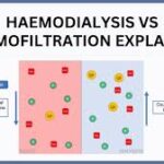 What Is the Difference Between Hemodialysis and Hemodiafiltration?