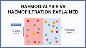 What Is the Difference Between Hemodialysis and Hemodiafiltration?