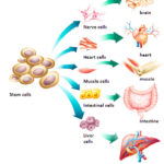 How much does it cost to preserve stem cells in Germany? 3 How much does it cost to preserve stem cells in Germany?