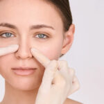 Celebrity Inspired Rhinoplasty in Dubai: Discreet, High Profile Transformations 3 Celebrity Inspired Rhinoplasty in Dubai: Discreet, High Profile Transformations