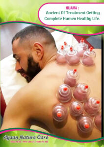 Cupping therapy Ayaan nature care | Hydra Facial in Chennai | Ayurveda in Chennai Foot reflexology in chennai 1 Cupping therapy Ayaan nature care | Hydra Facial in Chennai | Ayurveda in Chennai Foot reflexology in chennai