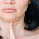 Double Chin Liposuction in Islamabad for Jaw Clarity