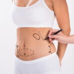 Liposuction in Dubai: A Leading Destination for Body Contouring