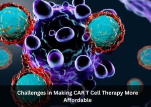 Challenges in Making CAR T Cell Therapy More Affordable