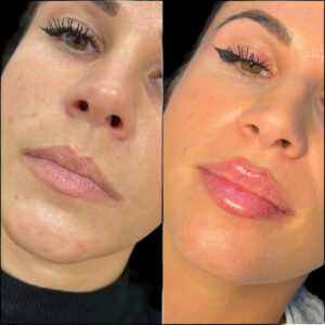 Best Plastic Surgeons in Dubai for Natural Facial Definition