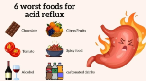 Worst Foods for Acid Reflux: What to Avoid to Prevent Heartburn