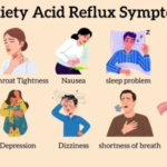 Can Stress Cause Acid Reflux? Causes, Symptoms, and Relief 3 Can Stress Cause Acid Reflux? Causes, Symptoms, and Relief