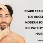 Beard Transplant Los Angeles: A Modern Solution for Patchy Facial Hair
