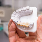 Cosmetic Dentistry Treatments Offered at Bridges Dental Valrico