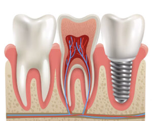 Dental Hospital in Vijayawada | Best Dental Clinic in Vijayawada | Dentist in Vijayawada – Dr. K. VARUN REDDY