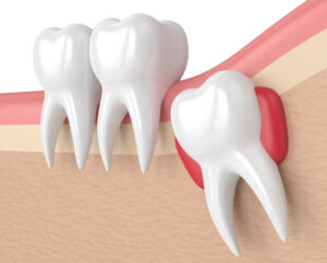 Capital Dental Clinic in Madinaguda | Best Dental Hospital in Madinaguda – Dr. Yamini Mannava
