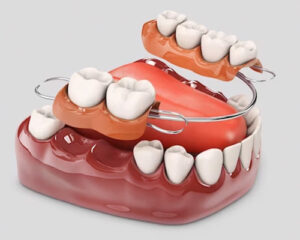 Viha Dental Clinic in Kukatpally | Best Dental Hospital in Kukatpally | Dentist in Kukatpally - Dr. Meenakshi Mudnoor 1 Viha Dental Clinic in Kukatpally | Best Dental Hospital in Kukatpally | Dentist in Kukatpally – Dr. Meenakshi Mudnoor