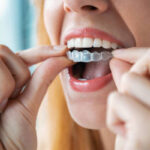 Dental Clinic in Nallagandla | Best Dental Hospital in Nallagandla | Dentist in Hyderabad – Dr. Ravi Gurram