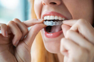 Dental Clinic in Nallagandla | Best Dental Hospital in Nallagandla | Dentist in Hyderabad – Dr. Ravi Gurram