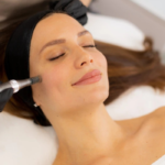 PRP Microneedling Toronto: Painful or Comfortable?