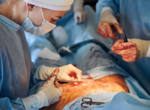 Why Consult a Gastro & Laparoscopic Surgeon in Jaipur Early? 1 Why Consult a Gastro & Laparoscopic Surgeon in Jaipur Early?