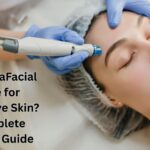 Is HydraFacial Safe for Sensitive Skin? Complete Safety Guide