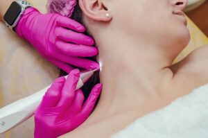 Effective Mole & Skin Tag Removal: Best Treatment Options 1 Effective Mole & Skin Tag Removal: Best Treatment Options