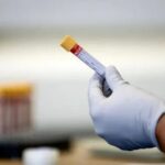Hepatitis A Test After Exposure What You Should Do