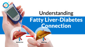 Fatty Liver and Diabetes: What I Need to Know for Long-Term Health
