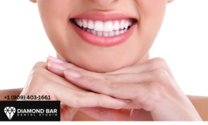 Tooth Decay Treatment Diamond Bar: Dental Fillings Guide