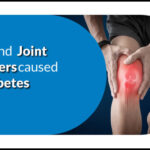 Bone and Joint Problems Caused by Diabetes