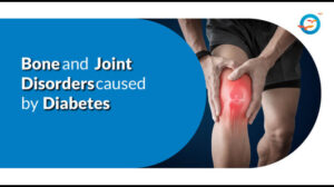 Bone and Joint Problems Caused by Diabetes