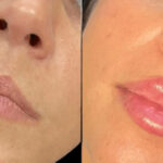 DtuHwfhiOaGgPJHUqhBe 06 7e894cdddf23bdf35b0bfb7ca4ac2a4e image