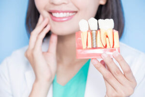 Complete Guide to Dental Implants for Missing Teeth 1 Complete Guide to Dental Implants for Missing Teeth