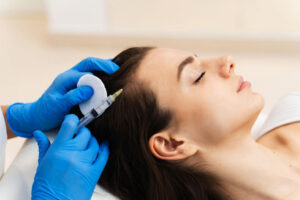 Can PRP Treatment Really Regrow Hair?