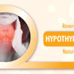 Reversing Hypothyroidism Naturally