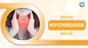 Reversing Hypothyroidism the Natural Way 1 Reversing Hypothyroidism the Natural Way