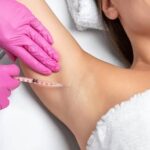 Axillary Hyperhidrosis Treatment3