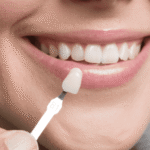 Italian Dental Clinic Dubai: Premium Dental Care for Your Smile