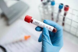 HIV Test in Dubai: Confidential and Private Options