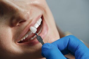 Foods to Eat and Avoid After Dental Implant Surgery