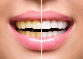 Healthy Smiles Start Early: Preventive Dental Care for the Whole Family 1 Healthy Smiles Start Early: Preventive Dental Care for the Whole Family