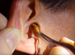 The Connection Between Ear Hygiene and Overall Wellness