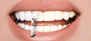 What Should You Do During a Dental Emergency Scarborough?