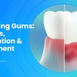 Week 12 Receding Gums 768x433 1