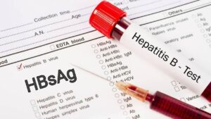 Hepatitis B Test Results Explained for Patients