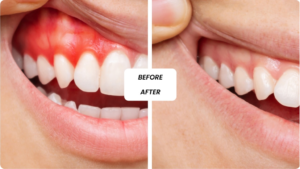 General Dentistry in Dubai: Preventive and Restorative Dental Treatments for Strong Teeth and Healthy Oral Hygiene