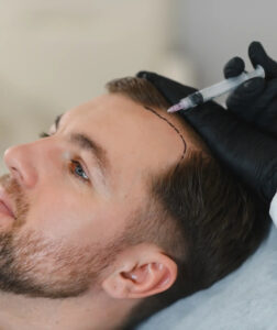 Hair Transplant in Dubai: Advanced Hair Restoration Methods for Natural-Looking Results