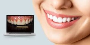 How Digital Smile Designing Can Transform Your Smile with Precision
