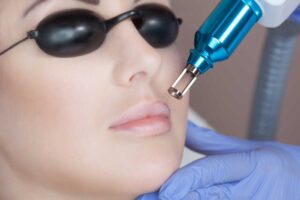 How Can Pink Lips Laser Treatment Help Achieve Perfect Lip Hue