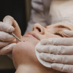 Threads facial treatment:Improving Charm with Accuracy and Treatment