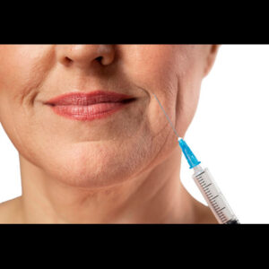 Tired of Dark Circles? Book Under Eye Dermal Fillers for a Brighter, Youthful Look