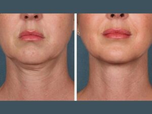 Best Plastic Surgeon in Dubai Redefining Hair PRP Treatment Care