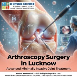 What to Look for in a Best Arthroscopy Surgeon in Lucknow for High Precision Joint Repairs